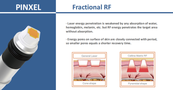 Portable Microneedle rf - Pinxel - Image 5