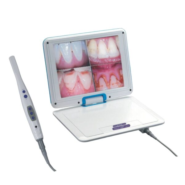 12.1 Inch LCD Screen CCD Dental Imaging Intraoral Camera