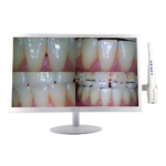 19 inch LCD Screen Sony 8.0 Mega 5G WiFi Wireless Handpiece Dental Intraoral Camera